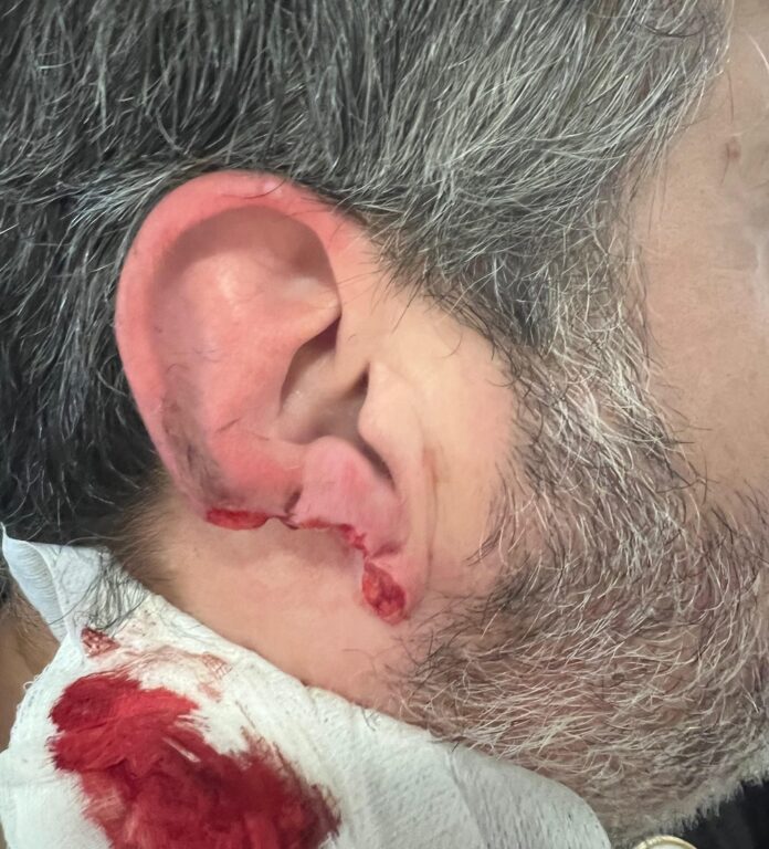 FOTO AGRESIÓN VIGILANTE Seguridade Hospital OZa