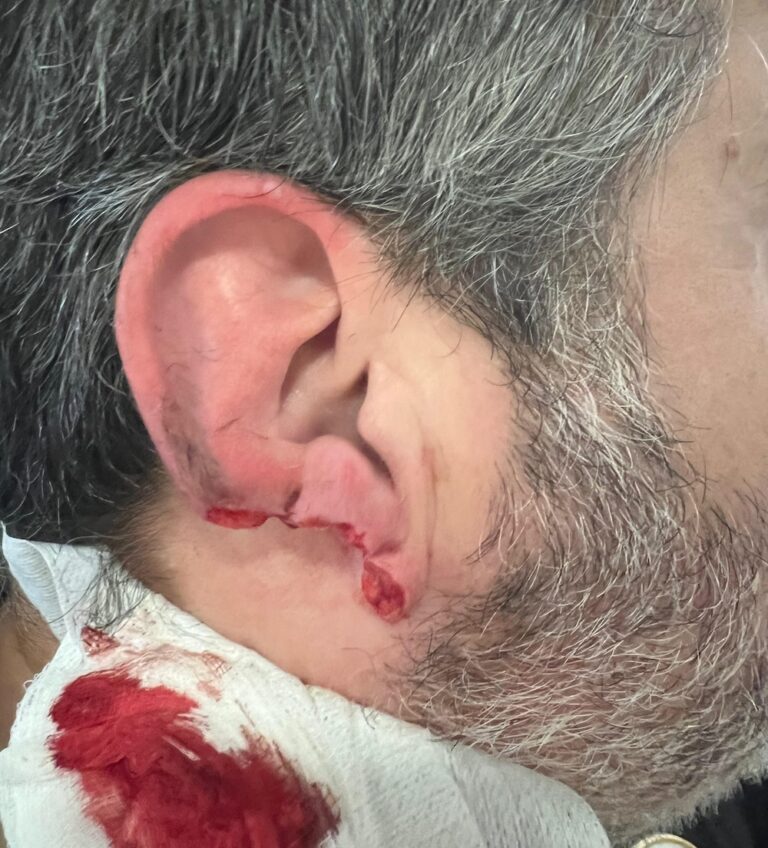 FOTO AGRESIÓN VIGILANTE Seguridade Hospital OZa